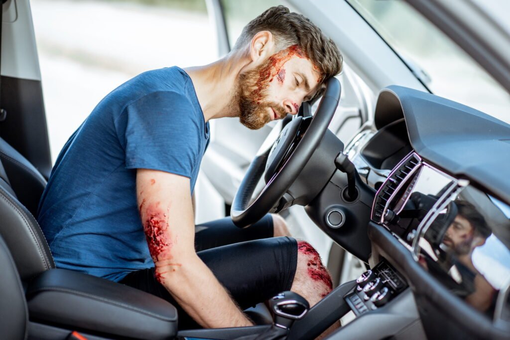 car accident injury